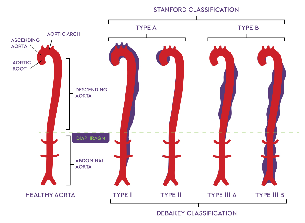 As part of a monetary settlement, mediated by Michael Mullin, the family of the decedent and the health care provider at issue collaborated on production of a video that was sent to hospitals around the United States alerting them to the need to inquire about family history of aortic dissection with young men and women entering emergency rooms with complaints of chest pain.<br />(Courtesty of John Ritter Foundation for Aortic Health)